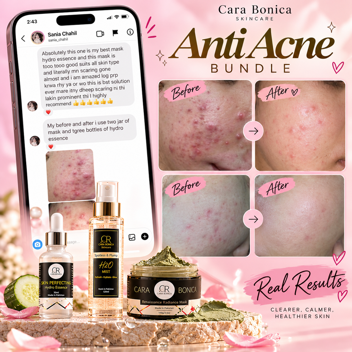 Anti Acne Deal (essence+h2O+mask)