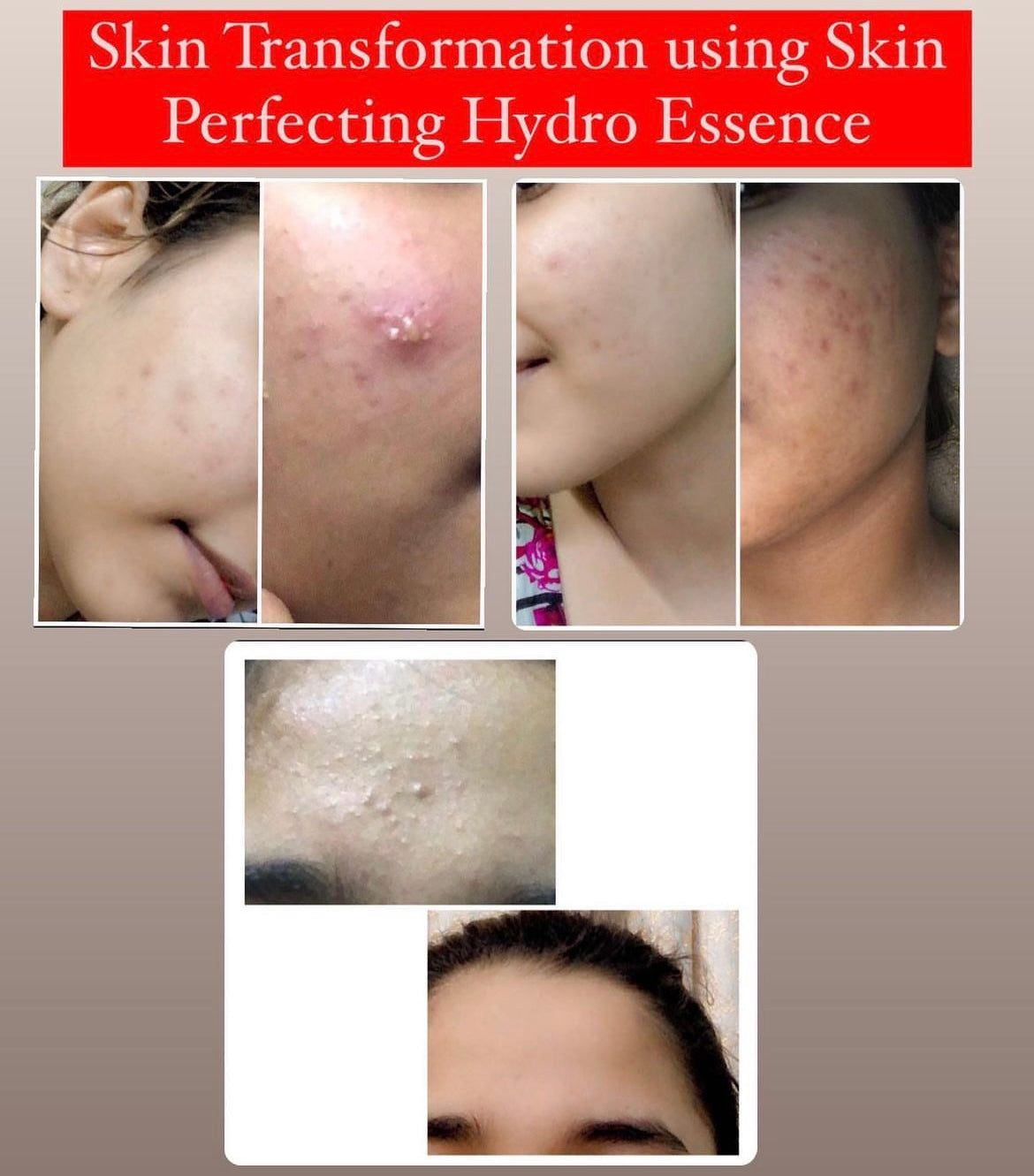 Skin Perfecting Hydro Essence